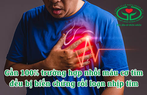 Rối loạn nhịp tim là biến chứng nhồi máu cơ tim phổ biến nhất