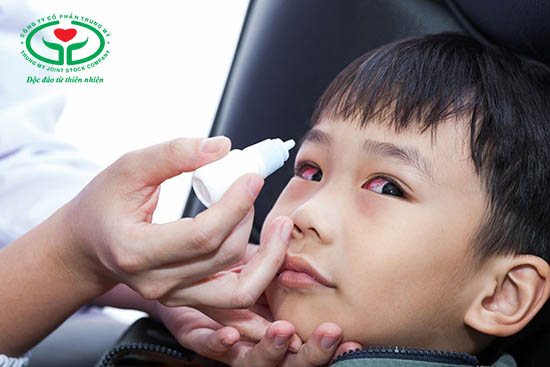 Biến thể Covid-19 XBB.1.16 dễ gây viêm kết mạc (đau mắt đỏ) ở trẻ em