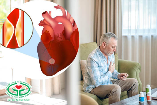 Bệnh mạch vành có nguy hiểm không? Có thể gây nhồi máu cơ tim nguy hiểm